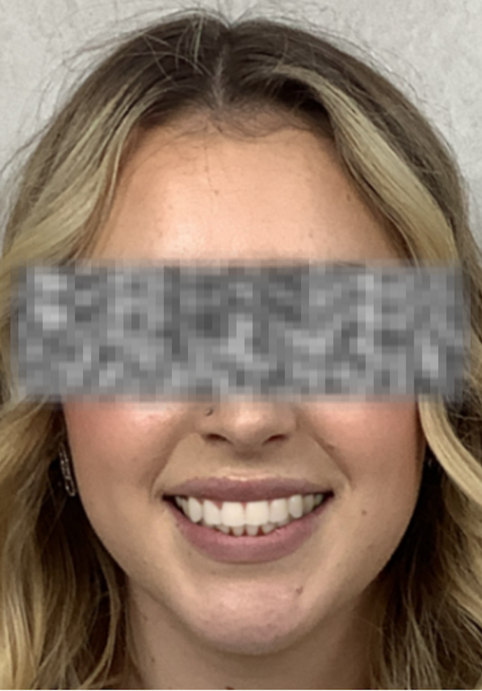 Example Image